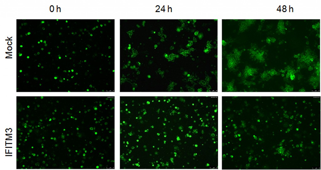 Cells that expressed IFITM proteins (bottom row), showed much less spread of HIV-1 compared with cells lacking the protein. | courtesy Jordan Wilkins, Liu Lab