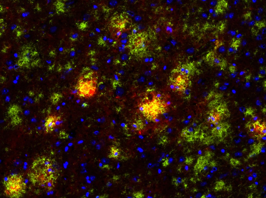 This is an immunofluorescence picture of a brain from an Alzheimer's disease mouse model, also known as the TgCRND8 mouse. In the picture the amyloid beta plaques have been stained green and the microglia, immune cells of the brain, are stained red. Image courtesy of Luke Woods. 